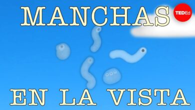 ¿Qué son esas cositas que parecen manchas en la vista? – Michael Mauser